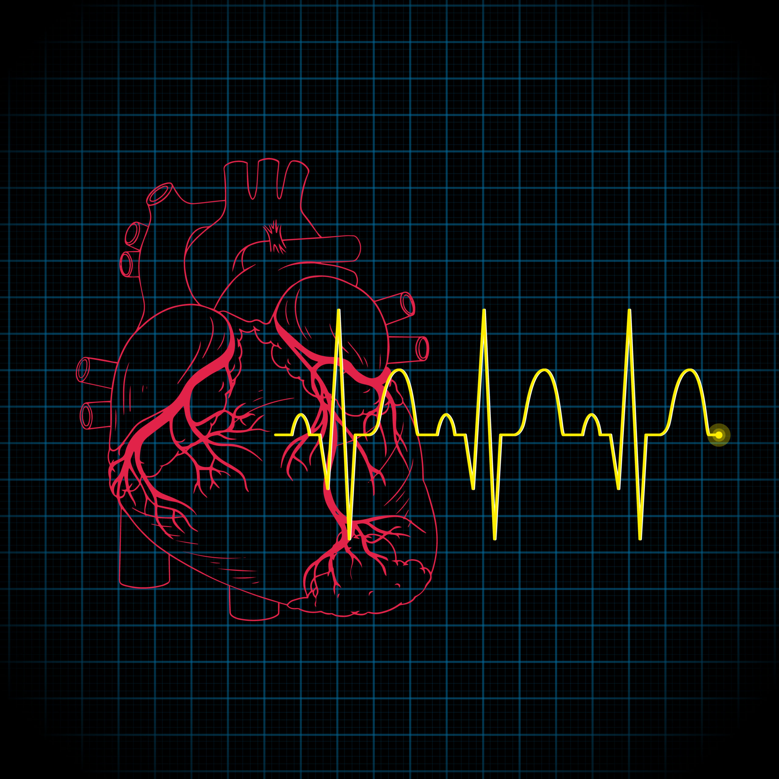 ECG Test