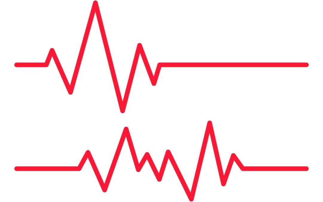 How Concerned Should Patients Be About an Irregular Heartbeat?